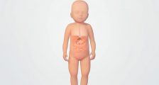 小儿胃底折叠术治疗胃食管反流病：三维医疗动画制作