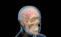 大脑脑部脑震荡开颅：手术三维动画制作、医学动画制作